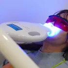 ホワイトニング
