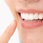 セラミック